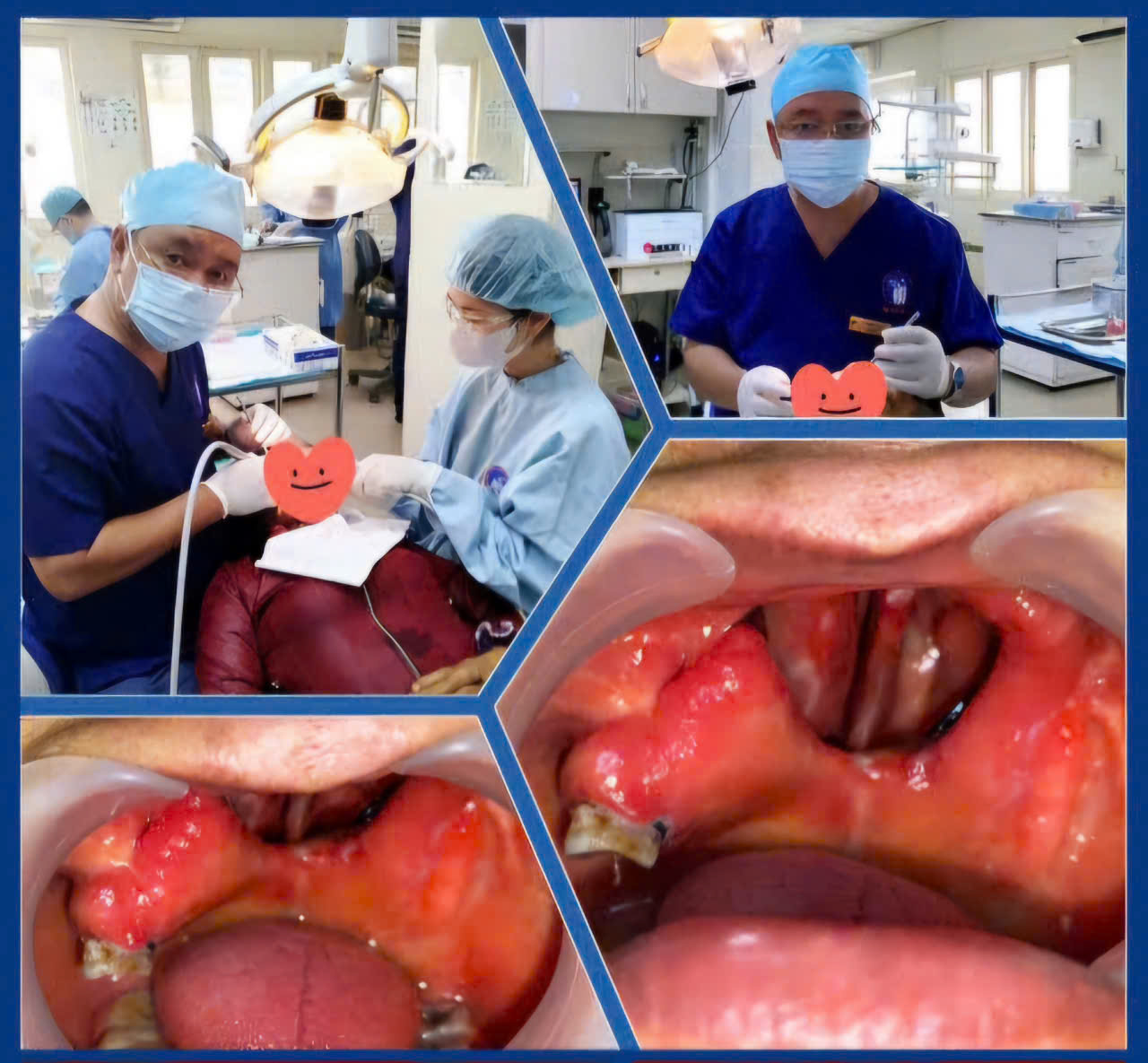 Bệnh viện răng hàm mặt trung ương TPHCM